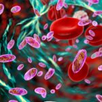 La inteligencia artificial reduce la mortalidad por sepsis en un hospital de Mallorca